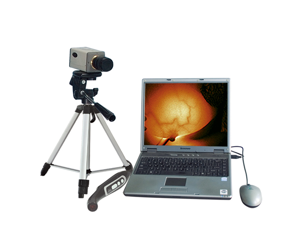 Digital electronic colposcopy